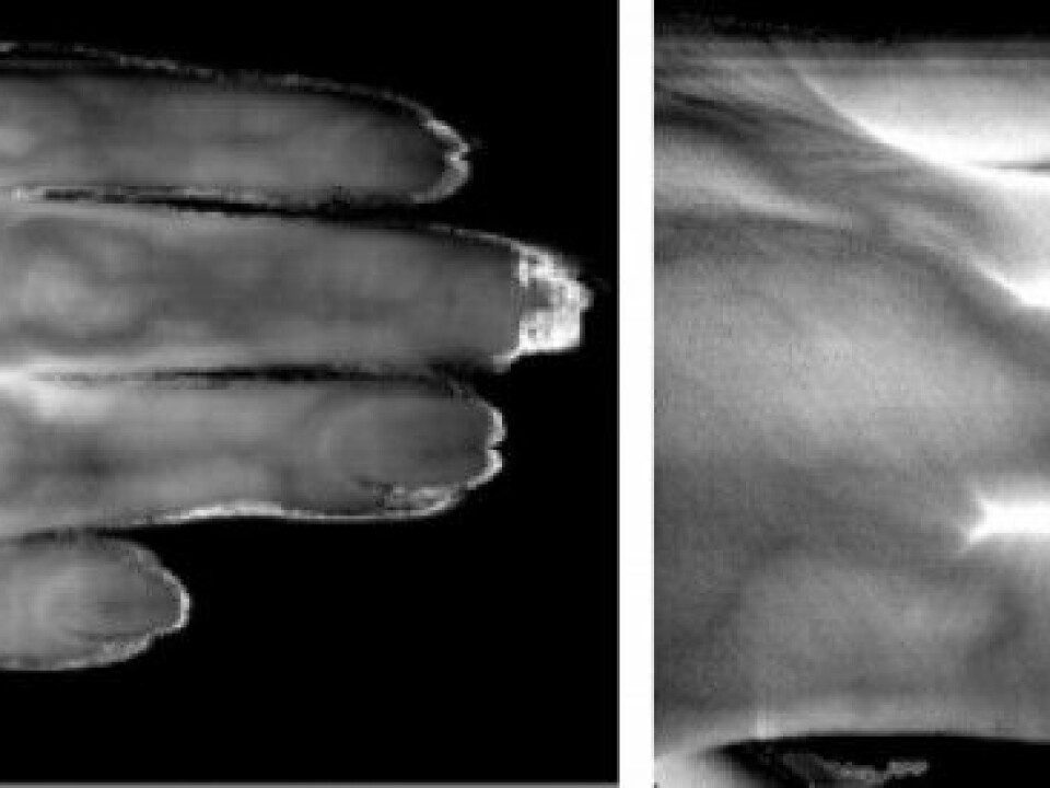 Hyperspectral photos show details in the fingers. (Photo: Lise Randeberg)