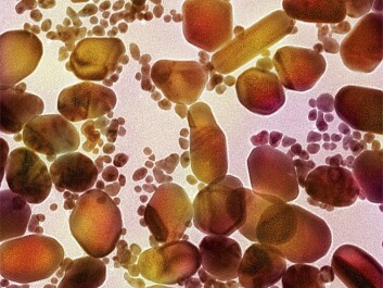 Naturally occurring nano-particles are found in soil, and in water and salt from sea spray. Man-made nano-particles are found in soot and smoke from fossil fuel combustion. The third category of nano-particles are those that have been designed by humans because of their special size or surface characteristics, such as the gold nano-particles shown in the photo. (Photo: David McCarthy/Science Photo Library)
Naturally occurring nano-particles are found in soil, and in water and salt from sea spray. Man-made nano-particles are found in soot and smoke from fossil fuel combustion. The third category of nano-particles are those that have been designed by humans because of their special size or surface characteristics, such as the gold nano-particles shown in the photo. (Photo: David McCarthy/Science Photo Library)