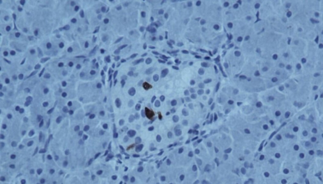 The dark patches are viral components in the insulin-producing cells in the islets of Langerhans. (Photo: DiViD) The dark patches are viral components in the insulin-producing cells in the islets of Langerhans. (Photo: DiViD)