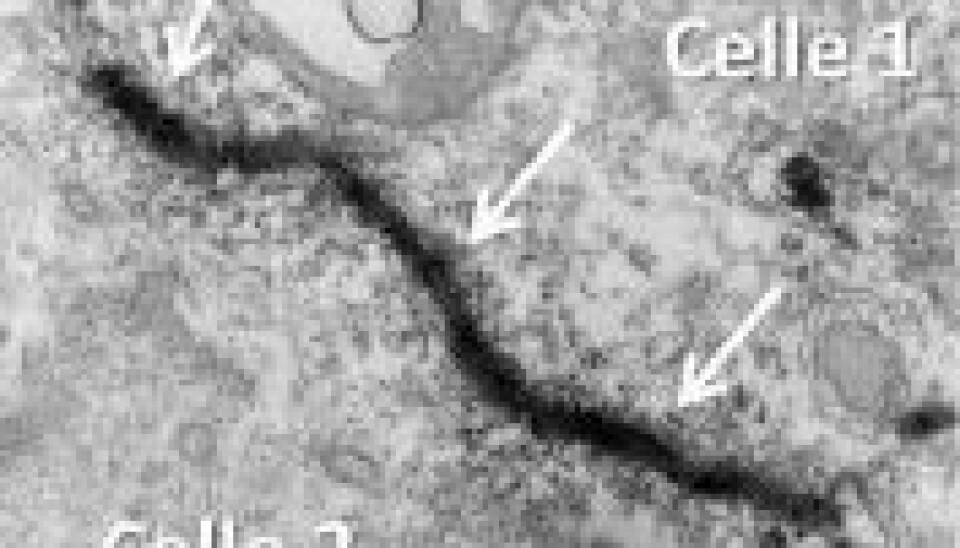 Image 1: The mutant CEL-protein has aggregated, the arrows showing how it aligns at the membrane between two cells. (Photo: Bente B. Johansson, The Molecular Imaging Centre (MIC), UiB)