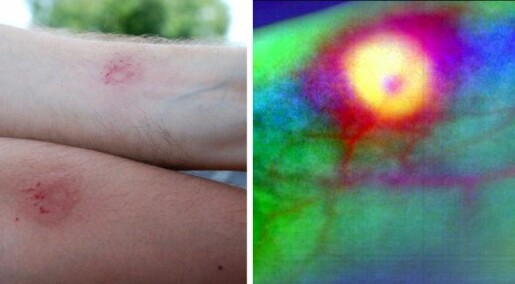 Charting sores and bruises in multiple colours