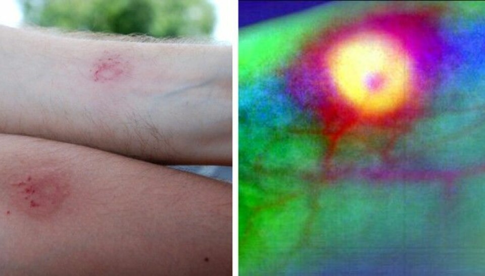 Left: Sores caused by paintball shots.  Right: A hyperspectral image of a comparable injury. A computer analysis can provide a picture of subcuticle tissue damage layer by layer. (Photos: left: Lise Randeberg, NTNU. Right: Lise L. Randeberg et. al: Hyperspectral Imaging of Bruises in the SWIR Spectral Region, Photonic Therapeutics and Diagnostics VIII, Proc. of SPIE Vol. 8207, 2012.)