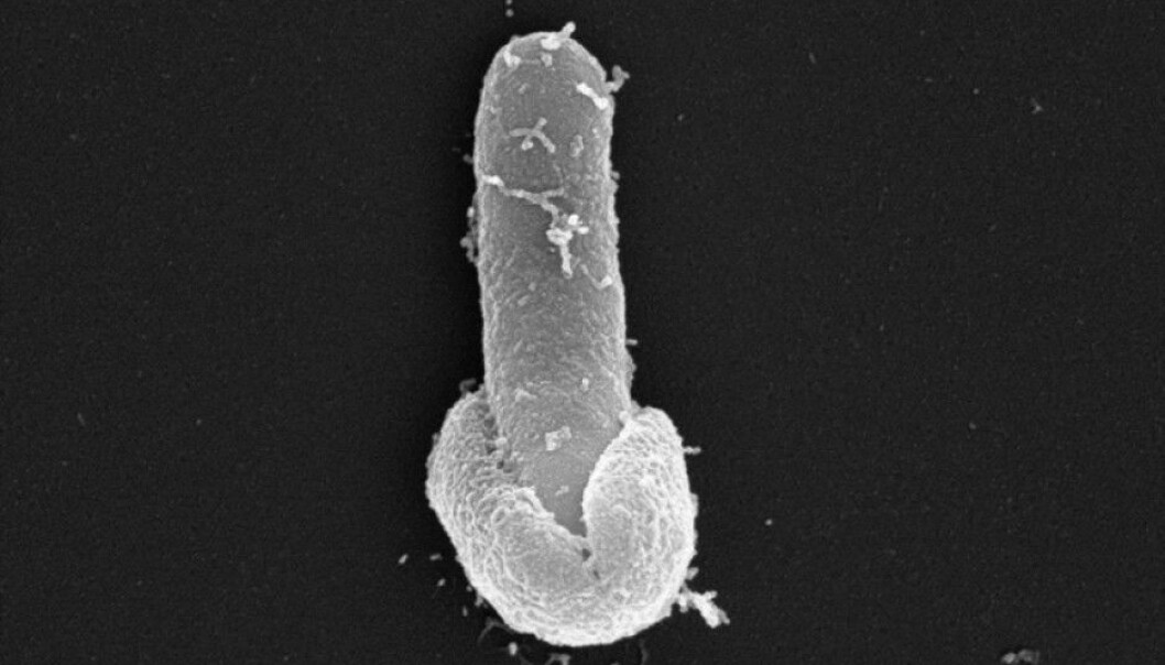 A bacteria like this can have gone dormant a thousand years ago. But it wakes up when you make some rice or pasta in the kitchen. The result can be nausea, vomiting, stomach cramps and diarrhoea. The photo shows Bacillus licheniformis emerging from its endospore shell and was captured by scanning-electron microscope by Antje Hoenen (SEM Lab, University of Oslo) and Elisabeth H. Madslien (The Norwegian Defence Research Establishment).