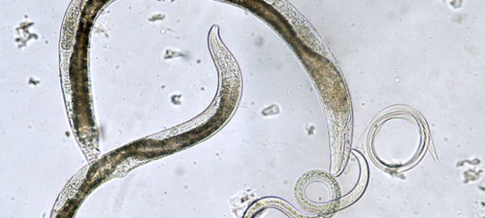 Dead parasites in your sushi can trigger allergic reaction