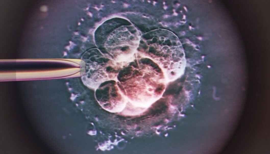 A human embryo as it appears two to three days after artificial insemination. A new study suggests that the same reasons may underlie an increased breast cancer risk and the inability to have children without reproductive help. A human embryo as it appears two to three days after artificial insemination. A new study suggests that the same reasons may underlie an increased breast cancer risk and the inability to have children without reproductive help.