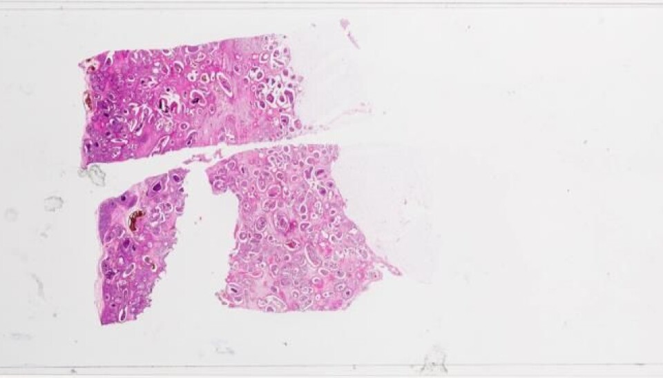 Researchers at UiB have conducted successful trials of a new type of chemotherapy. (Photo: Eivind Senneset, UiB)