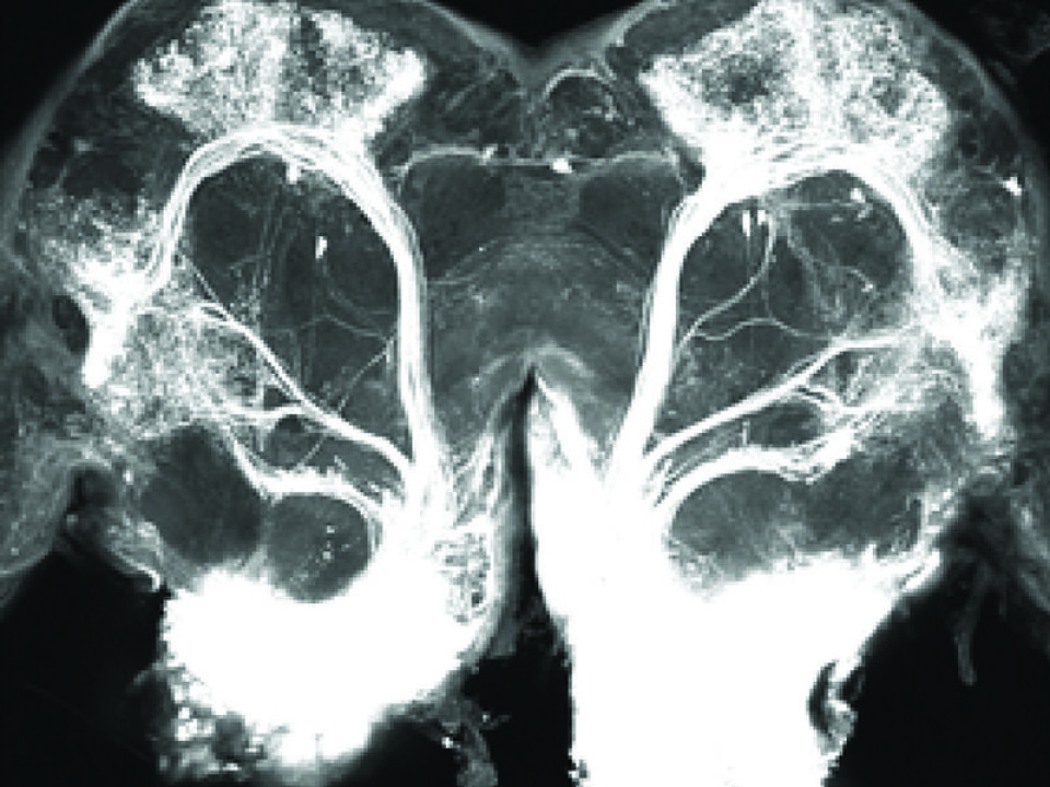 The white areas at the bottom of the photo are the male moth’s primary smell processing centre. The white structures at the top of the image are important for learning and memory. If the insect finds nutritious food, an olfactory memory is established so that the insect can later locate food. (Illustration: NTNU)