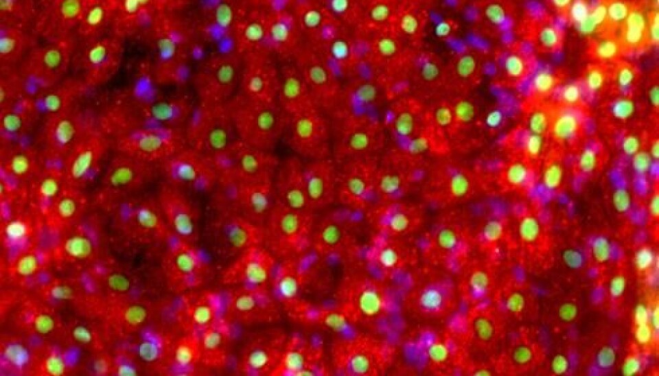 Synthetic liver cells produced using small molecules. The method is both robust and cost-effective. (Photo: Gareth Sullivan)