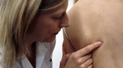 New skin cancer genes located New skin cancer genes located