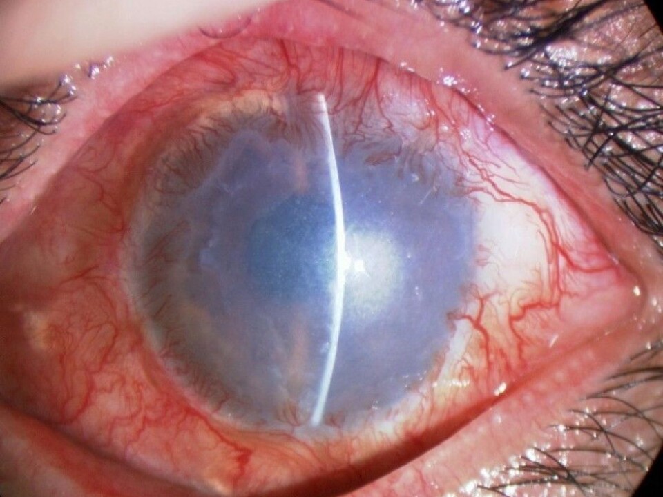 (Photo: Dr. Takahiro Nakamura, Department of Ophtalmology, Kyoto Prefectural University of Medicine)