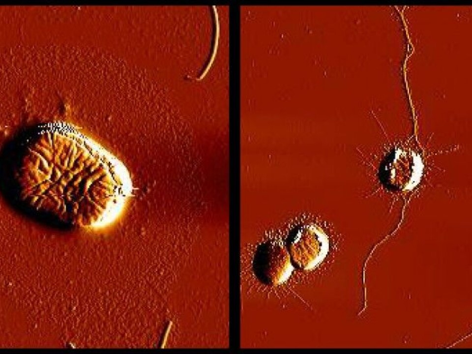 TheE. coli-bacteria have genes that code for filamental structures, making it easier for the bacteria to attaching to surfaces. To the left, we see an E. coli- bacterium to which Thiophenone has been added. We can see that the threads are missing. To comparison, we see the bacteria to which Thiophenone has not been added to the right, and these bacteria have produced threads 'as normal'. (Photo: Ida Hegna, School of Pharmacy, UiO)