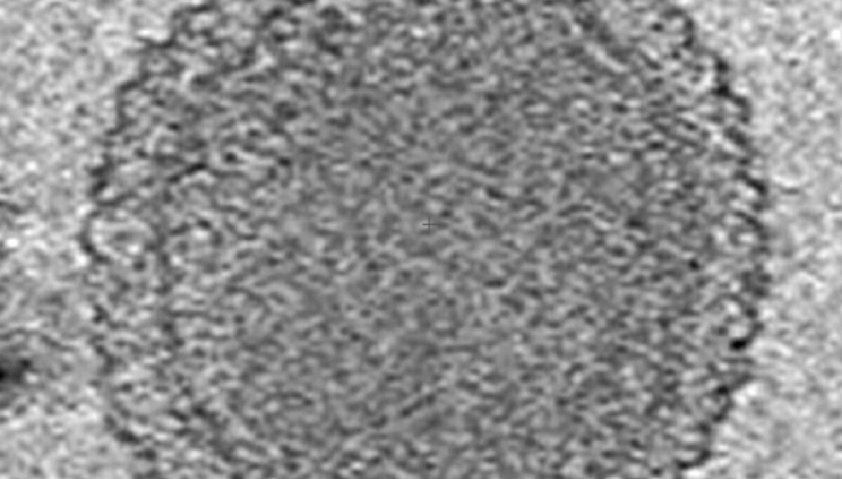Lesser Life Form Scientists find smallest life forms on Earth