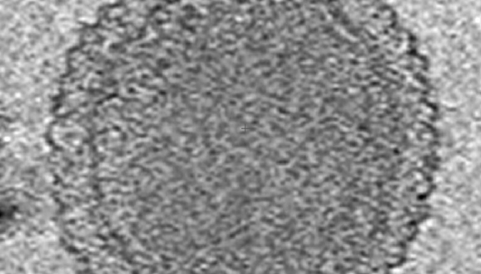 This cryogenic electron tomography image reveals the internal structure of an ultra-small bacterium. The cell has a very dense interior compartment and a complex cell wall. The image was obtained from a 3-D reconstruction. The scale bar is 100 nanometers. (Photo: Birgit Luef, UC Berkeley, NTNU)