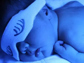 The jaundice app developed at NTNU can make it easier for parents to determine if their child needs to be treated for jaundice. (Photo: NTNU)