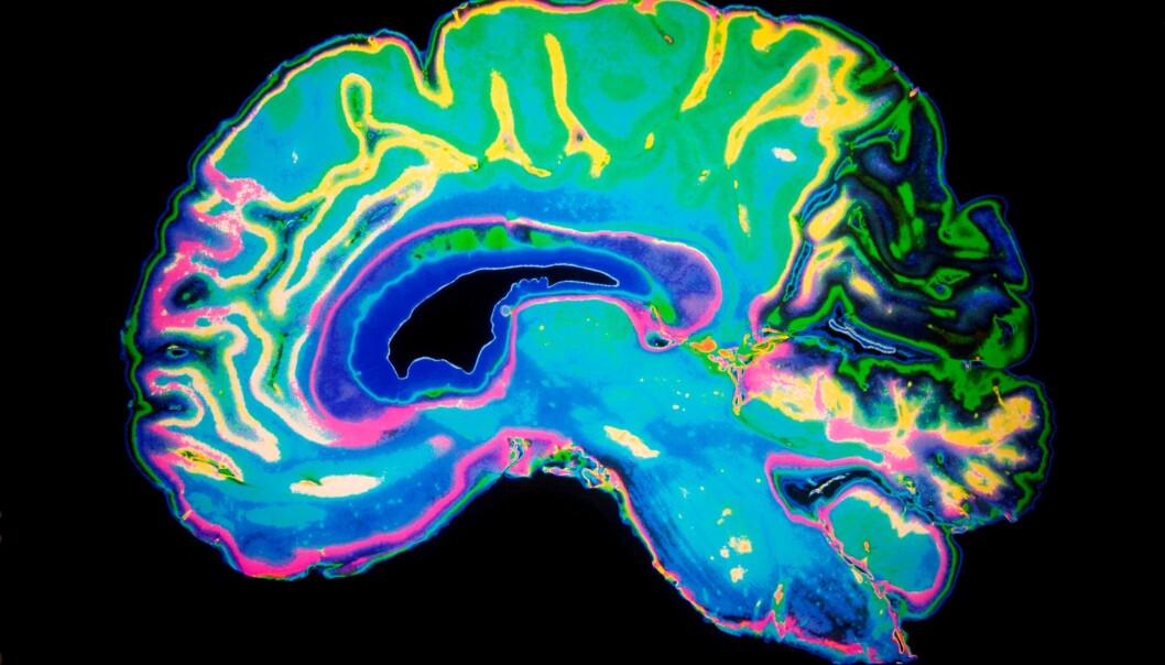 Professors Kenneth Hugdahl and Karsten Specht of the Bergen fMRI Group want to prove the existence of a cognitive network that connects all of the human brain. (Illustrative photo: Colourbox) Professors Kenneth Hugdahl and Karsten Specht of the Bergen fMRI Group want to prove the existence of a cognitive network that connects all of the human brain. (Illustrative photo: Colourbox)