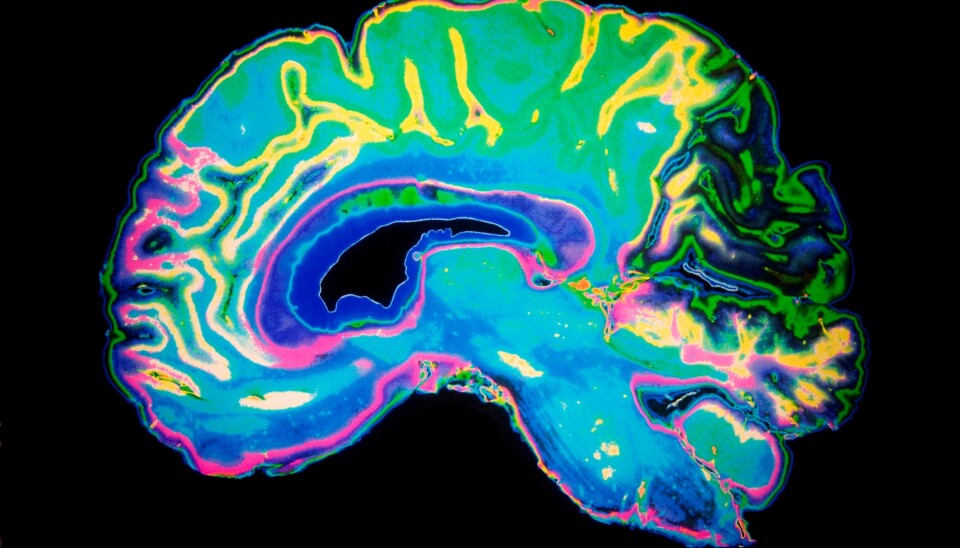 Professors Kenneth Hugdahl and Karsten Specht of the Bergen fMRI Group want to prove the existence of a cognitive network that connects all of the human brain. (Illustrative photo: Colourbox)