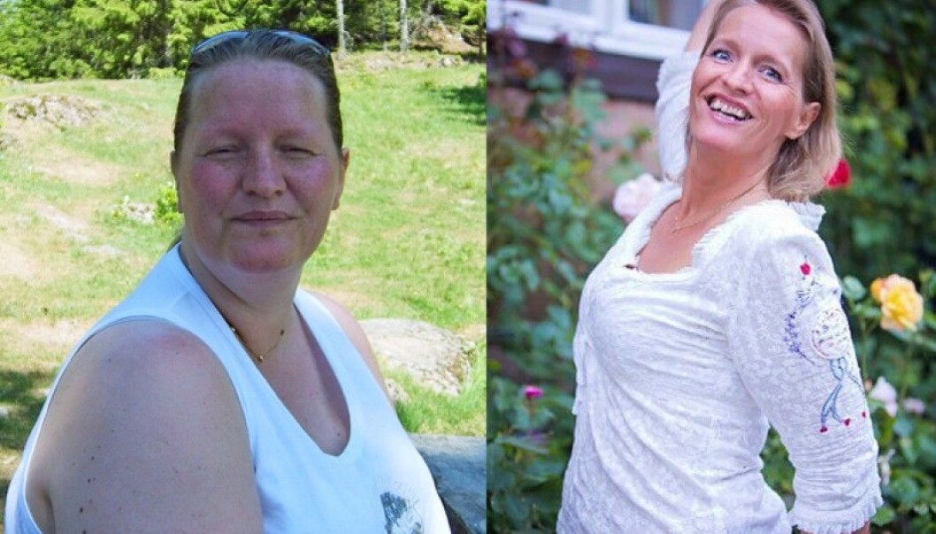 Hege Friberg had an operation to help her lose weight seven years ago. It changed her life, but not quite in the way she had imagined beforehand. (Photo: private) Hege Friberg had an operation to help her lose weight seven years ago. It changed her life, but not quite in the way she had imagined beforehand. (Photo: private)