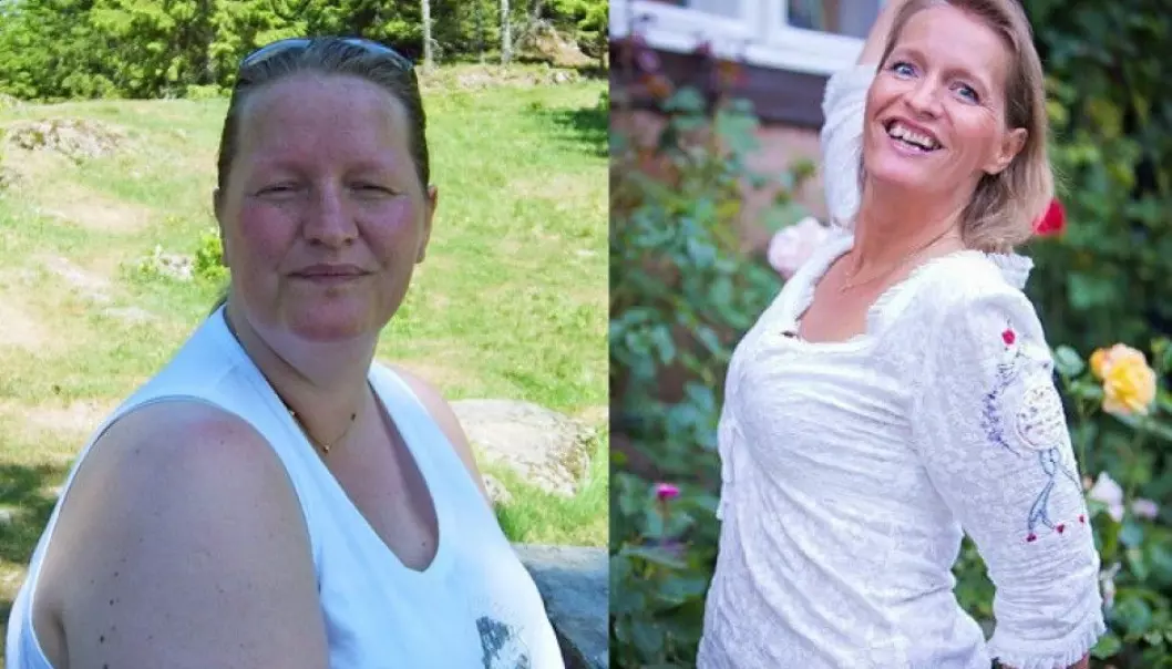 Hege Friberg had an operation to help her lose weight seven years ago. It changed her life, but not quite in the way she had imagined beforehand. (Photo: private)