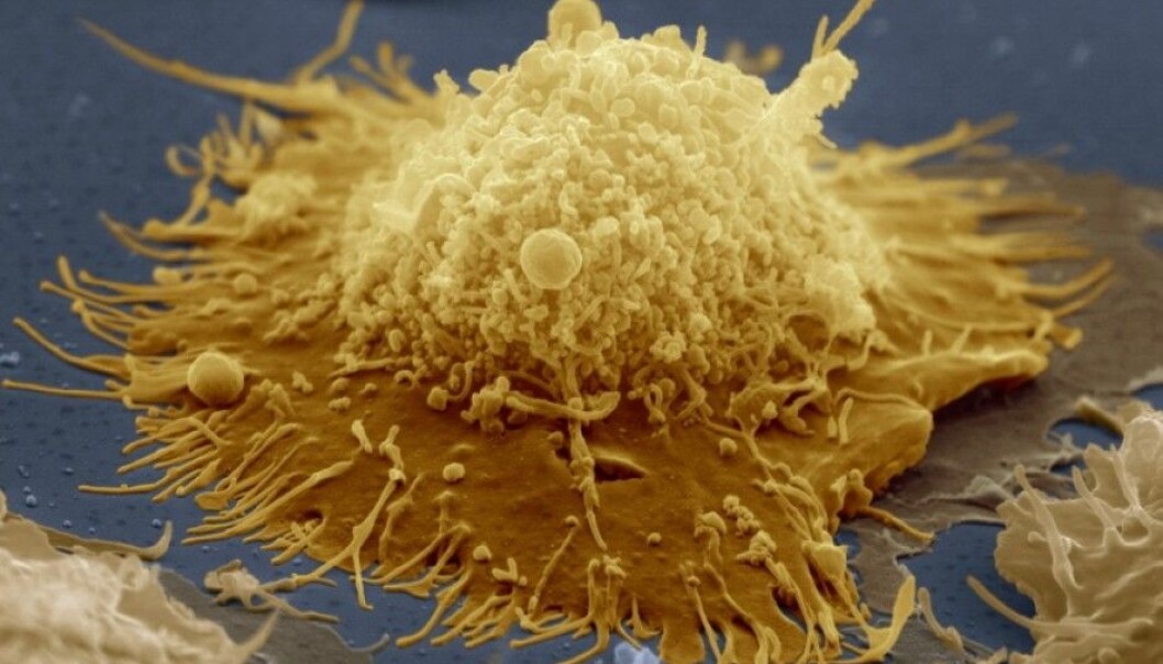 The photo shows a B-cell. B cells are lymphocytes, which is a variation of white blood cells. These cells adapt for specific bacteria, so that they can recognize an attack later. This feature makes us immune to certain bacteria. (Photo: Science Photo Library / NTB Scanpix.) The photo shows a B-cell. B cells are lymphocytes, which is a variation of white blood cells. These cells adapt for specific bacteria, so that they can recognize an attack later. This feature makes us immune to certain bacteria. (Photo: Science Photo Library / NTB Scanpix.)