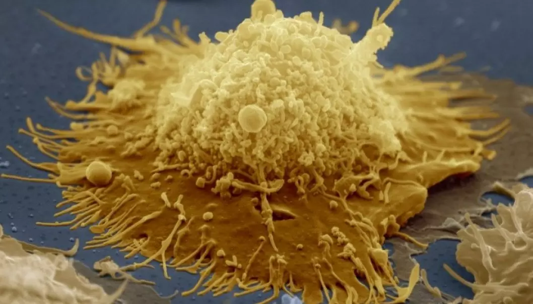 The photo shows a B-cell. B cells are lymphocytes, which is a variation of white blood cells. These cells adapt for specific bacteria, so that they can recognize an attack later. This feature makes us immune to certain bacteria. (Photo: Science Photo Library / NTB Scanpix.)