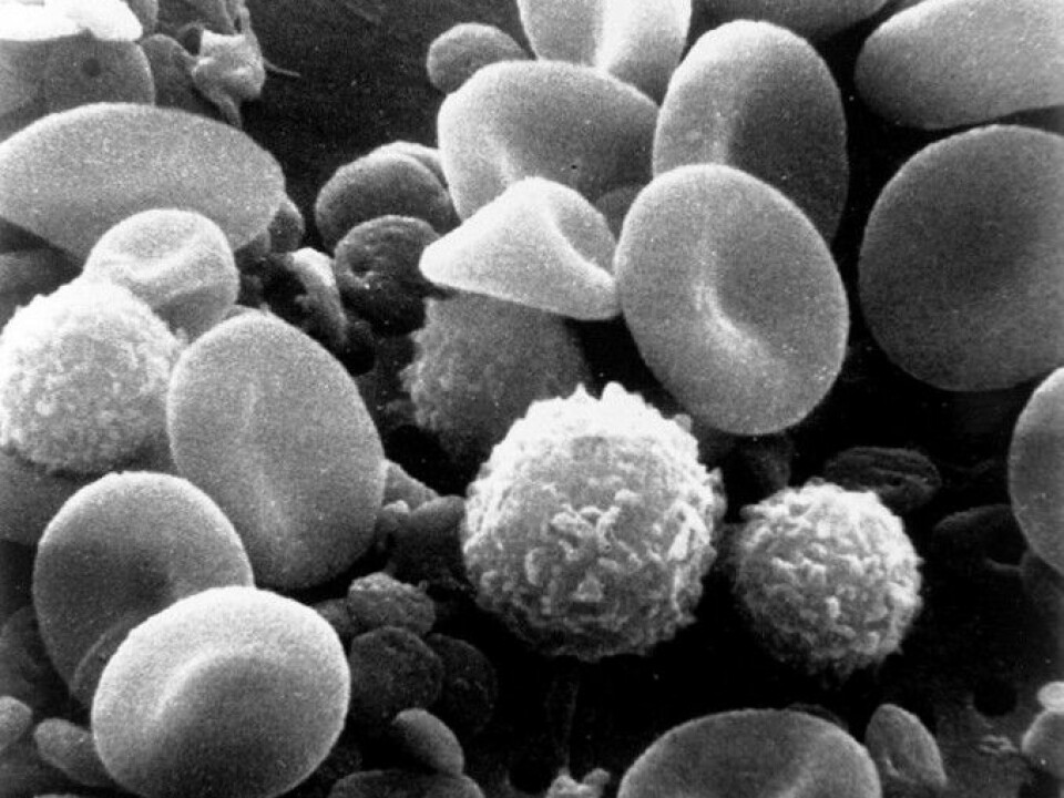 The image shows a close up picture of blood. You can clearly see the different components, cells with various functions. The ones that look almost like raspberries, are lymphocytes. Both B-cells and T-cells are lymphocytes. (Photo: Bruce Wetzel/Harry Schaefer/Wikimedia commons.)