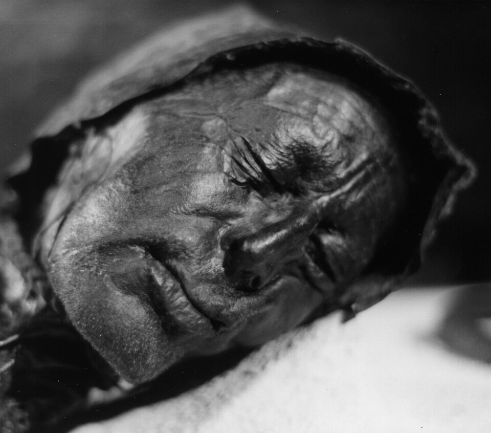 The Tollund Man's very well preserved face. He died around 300 BC.
