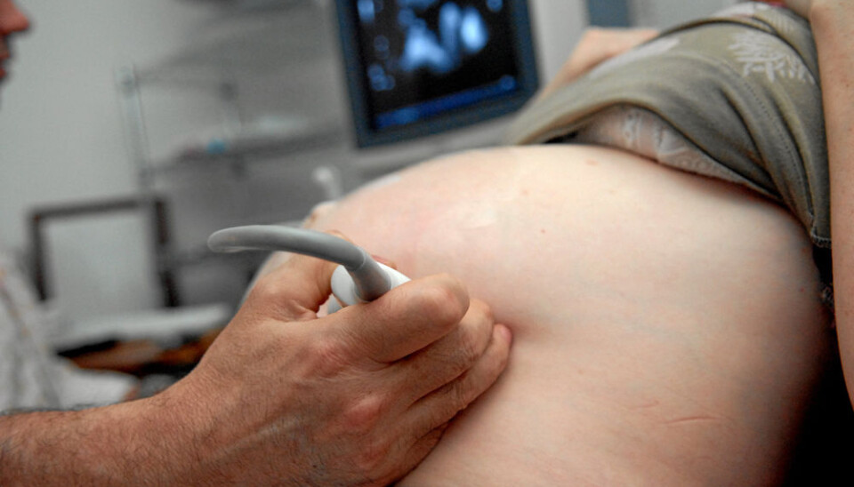 Reduced movement in the belly may be a sign that the baby is experiencing problems. (Photo: Colourbox)