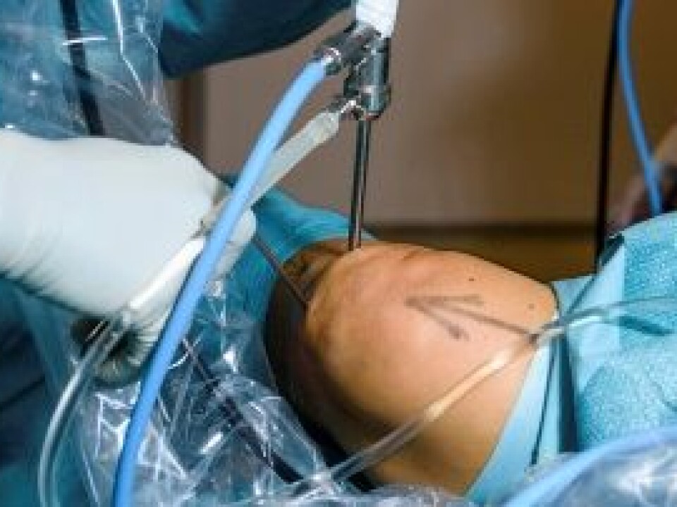 A reduction in the number of arthroscopic procedures for meniscus injuries could lead to substantial savings. (Photo: Øystein Horgmo, UiO)