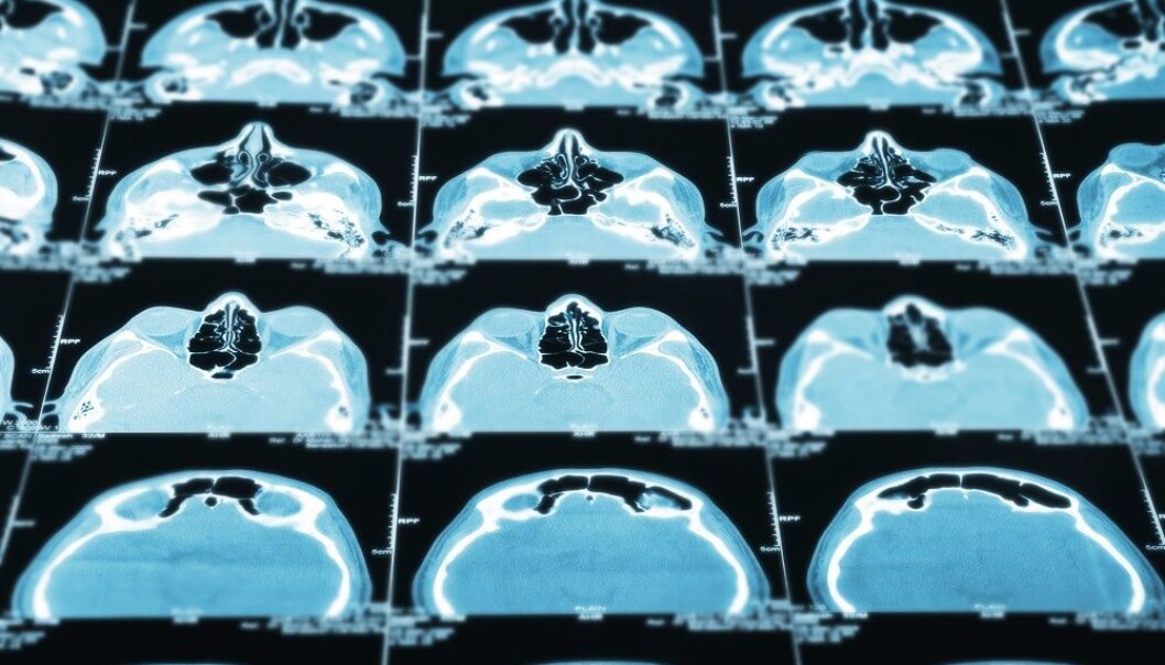 Due to technical limitations with early CT scanners, children were commonly exposed to the same radiation dose as adults. (Illustrative photo: Colourbox.) Due to technical limitations with early CT scanners, children were commonly exposed to the same radiation dose as adults. (Illustrative photo: Colourbox.)