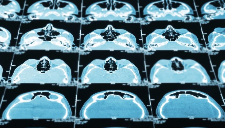 Due to technical limitations with early CT scanners, children were commonly exposed to the same radiation dose as adults. (Illustrative photo: Colourbox.)