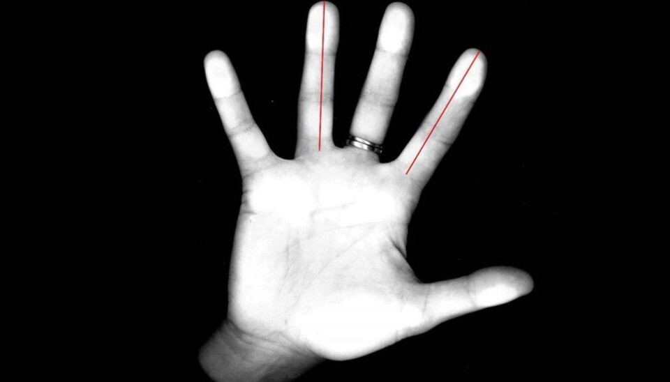 Researchers used a common photocopy machine to measure the lengths of the index and ring fingers of 42 women. Half of these women were asked to solve different mental tasks after they had been given a drop of testosterone on their tongue. The goal was to determine the differences in how men's and women's brains work, and the significance of finger length and testosterone levels. (Photo: Carl Pintzka / Kolbjørn Skarpnes, NTNU)