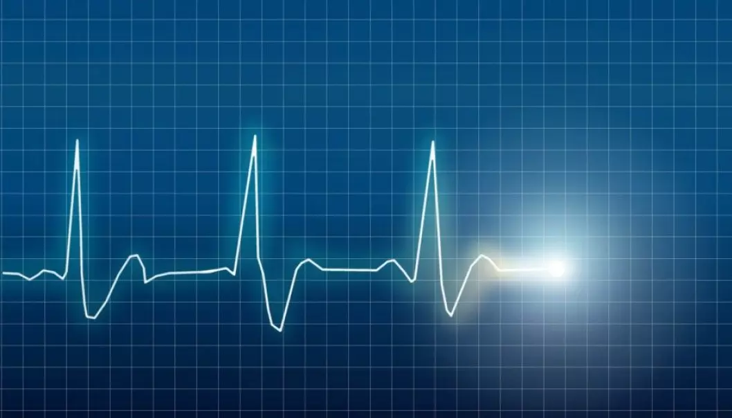 Illustration of an elektrocardiogram (ECG or EKG) of a heart. (Photo: Eskemar / Shutterstock / NTB scanpix)