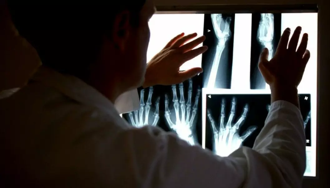 A Norwegian researcher has developed a promising new drug for treating rheumatoid arthritis. It blocks a key sex hormone that seems to have a role in the development of the disease. Above: x-rays of a patient are scrutinized on an illuminator at Diakonhjemmet University College’s rheumatism polyclinic in Oslo. (Photo: Aftenposten)