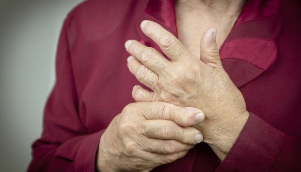 Rheumatoid arthritis is a painful disease that destroys the body’s joints. Drugs that inhibit bone and cartilage damage can give patients a better life. (Photo: Shutterstock / NTB scanpix)