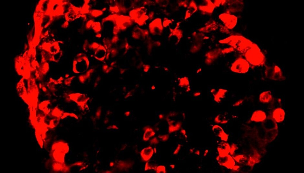 The red shapes above are former skin cells of Norwegian diabetes patients. They now extrude insulin, seen as the dark grey areas of the image. (Photo: Vethe et. al, Scientific Reports) The red shapes above are former skin cells of Norwegian diabetes patients. They now extrude insulin, seen as the dark grey areas of the image. (Photo: Vethe et. al, Scientific Reports)