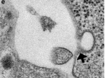 This cell was once a skin cell but now it secretes insulin. It has been programmed to do so via stem cell treatment. (Photo: Vethe et al, Scientific Report) This cell was once a skin cell but now it secretes insulin. It has been programmed to do so via stem cell treatment. (Photo: Vethe et al, Scientific Report)