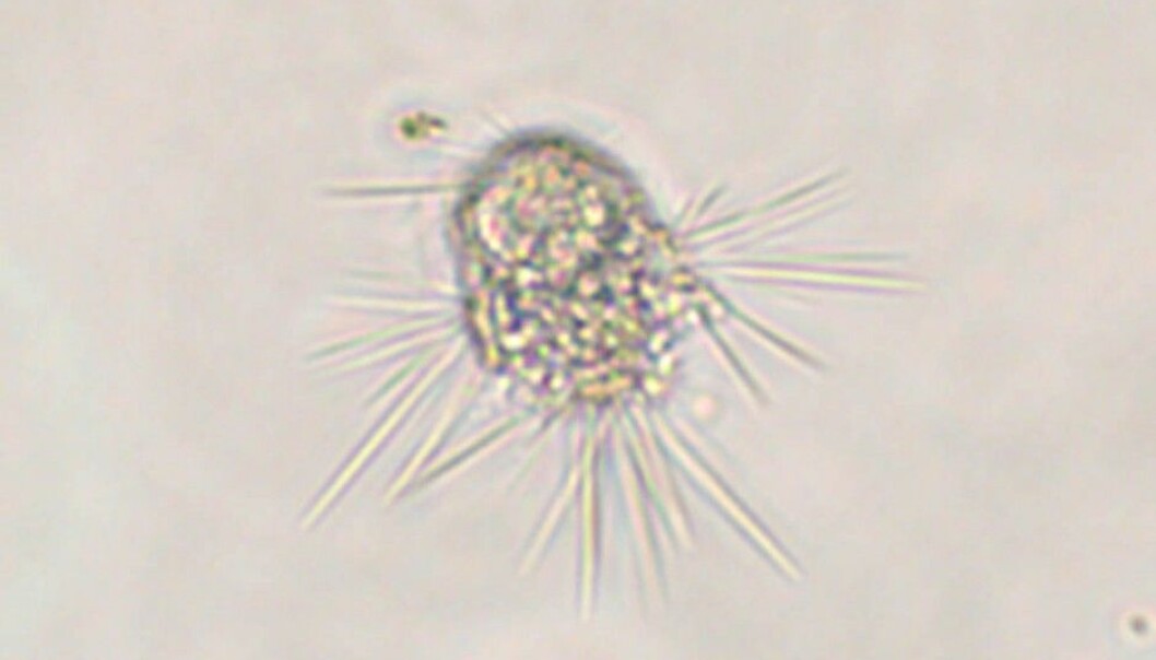 After uncounted hours of microscope viewing, Evolutionary Biologist Anders K. Krabberød spotted this specimen of Sticholonche, a single-celled marine organism. This particular individual helped researchers solve a 150-year-old biological mystery. (Photo: Anders K. Krabberød) After uncounted hours of microscope viewing, Evolutionary Biologist Anders K. Krabberød spotted this specimen of Sticholonche, a single-celled marine organism. This particular individual helped researchers solve a 150-year-old biological mystery. (Photo: Anders K. Krabberød)