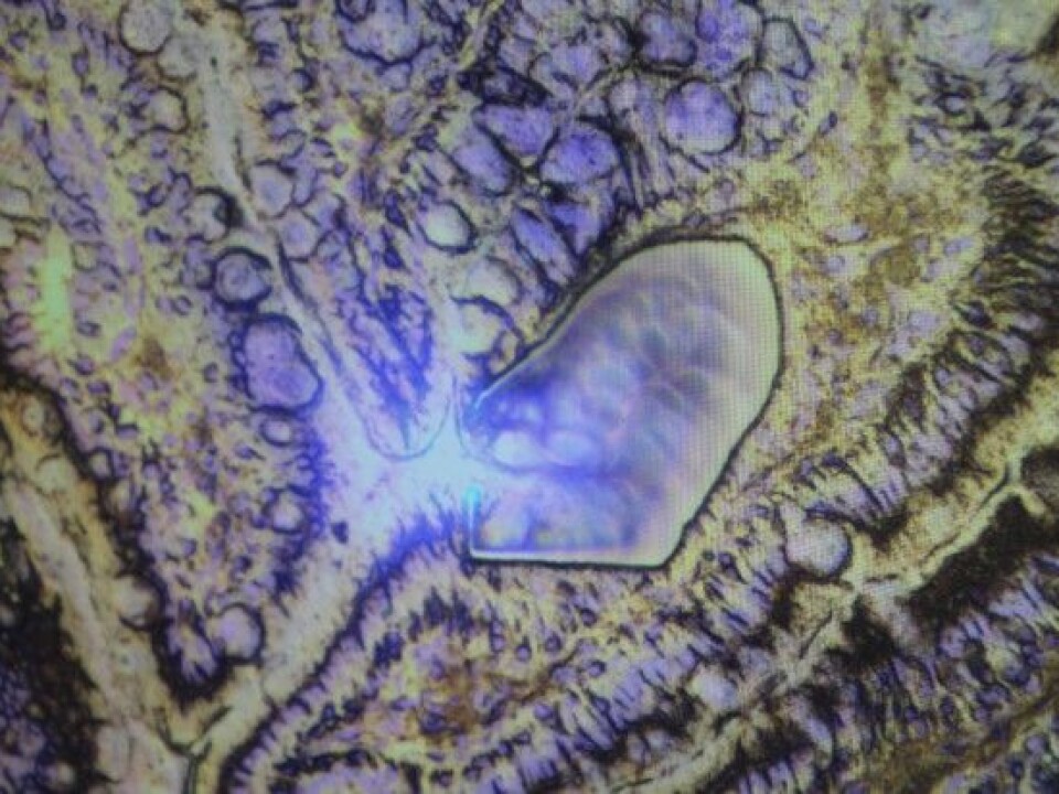 This image actually shows part of a pig's intestine. (Photo: Liv R. Bjergene)