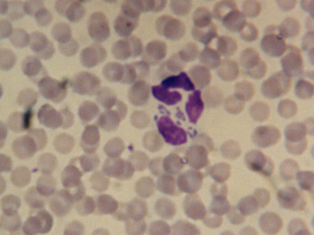 The bacterium that causes anaplasmosis can be found by looking at white blood cells under a light microscope, as is shown in this picture. (Photo: Snorre Stuen) The bacterium that causes anaplasmosis can be found by looking at white blood cells under a light microscope, as is shown in this picture. (Photo: Snorre Stuen)