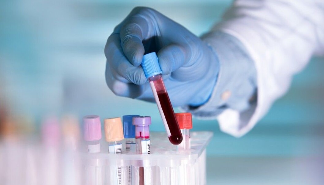 There is a substance in our blood that can predict our risk of future heart disease. Some people have more than others, which indicates a greater risk of heart problems. (Photo: Shutterstock) There is a substance in our blood that can predict our risk of future heart disease. Some people have more than others, which indicates a greater risk of heart problems. (Photo: Shutterstock)