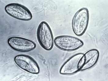 Pinworm eggs (Enterobius vermicularis) through a microscope. (Photo: CDC/Wikimedia Commons) Pinworm eggs (Enterobius vermicularis) through a microscope. (Photo: CDC/Wikimedia Commons)