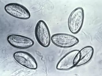Pinworm eggs (Enterobius vermicularis) through a microscope. (Photo: CDC/Wikimedia Commons)