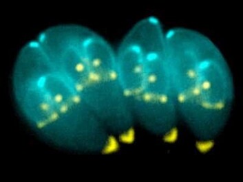 Toxoplasma cells with interior daughter cells. (Photo: Ke Hu and John Murray) Toxoplasma cells with interior daughter cells. (Photo: Ke Hu and John Murray)