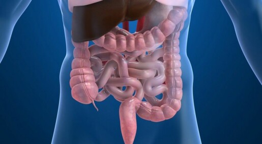 Large intestine may be source of woes for people with irritable bowel syndrome