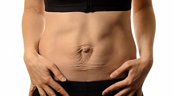Researchers have no idea how to fix your 'mummy tummy'