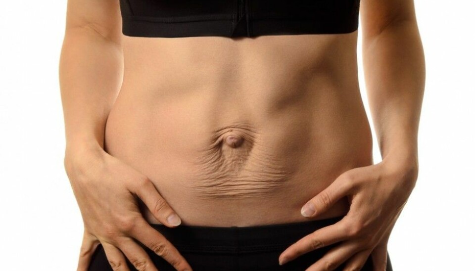 Researchers have no idea how to fix your 'mummy tummy