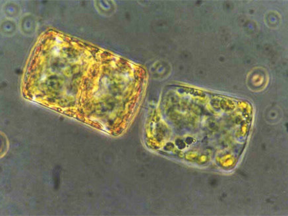Two diatoms which have linked together, viewed through a microscope. These belong to the species Thalassiosira bioculata. (Photo: Else Nøst Hegseth)