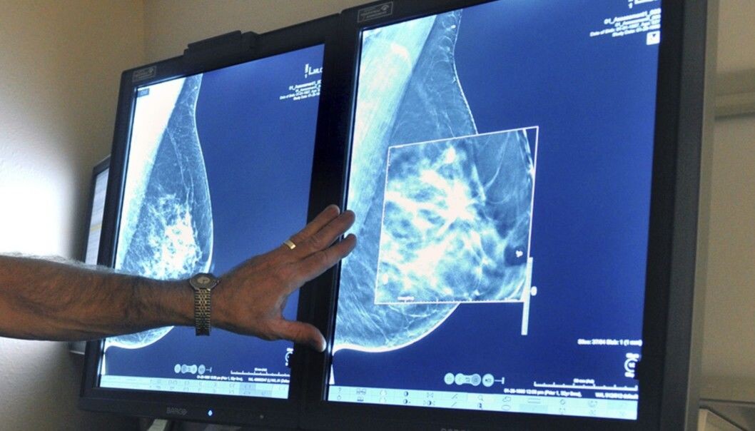 Tomosynthesis displays a 3D image of the breast and can detect more tumours than conventional mammography. But it is not yet clear how many of these newly detected tumours are actually cancerous or whether they pose a risk to women's health. (Photo: Torin Halsey / Times Record News via AP, NTB Scanpix) Tomosynthesis displays a 3D image of the breast and can detect more tumours than conventional mammography. But it is not yet clear how many of these newly detected tumours are actually cancerous or whether they pose a risk to women's health. (Photo: Torin Halsey / Times Record News via AP, NTB Scanpix)