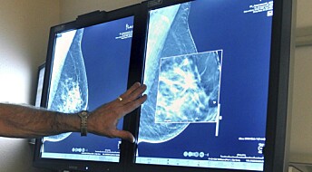 3D mammography can detect more tumours than conventional techniques
