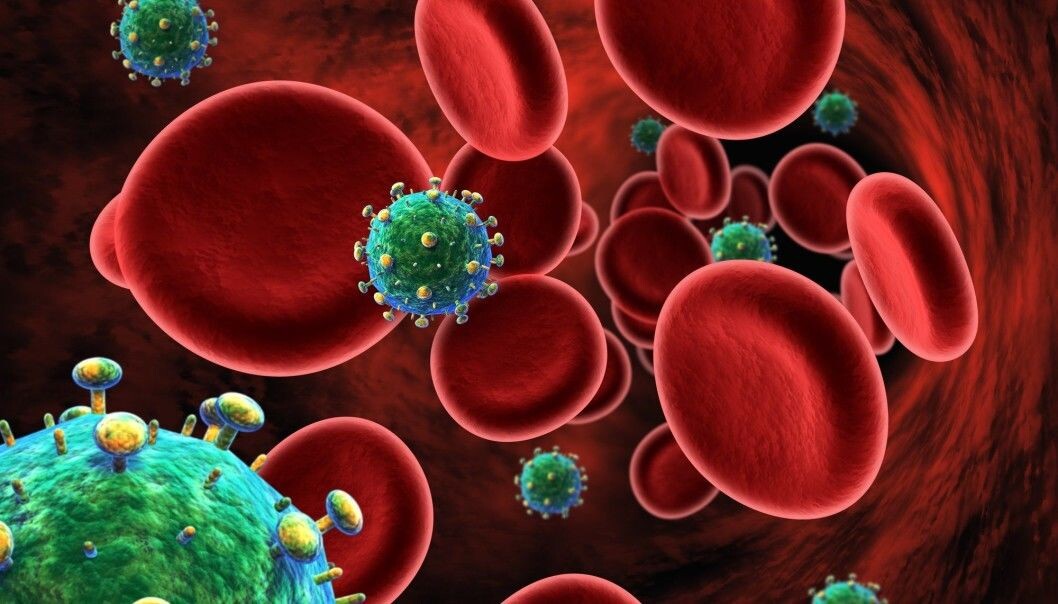 Human immunodeficiency virus (HIV) destroys the immune system so leaving sufferers more susceptible to infections and diseases that a healthy immune system would otherwise take care of. (Photo: Shutterstock). Human immunodeficiency virus (HIV) destroys the immune system so leaving sufferers more susceptible to infections and diseases that a healthy immune system would otherwise take care of. (Photo: Shutterstock).